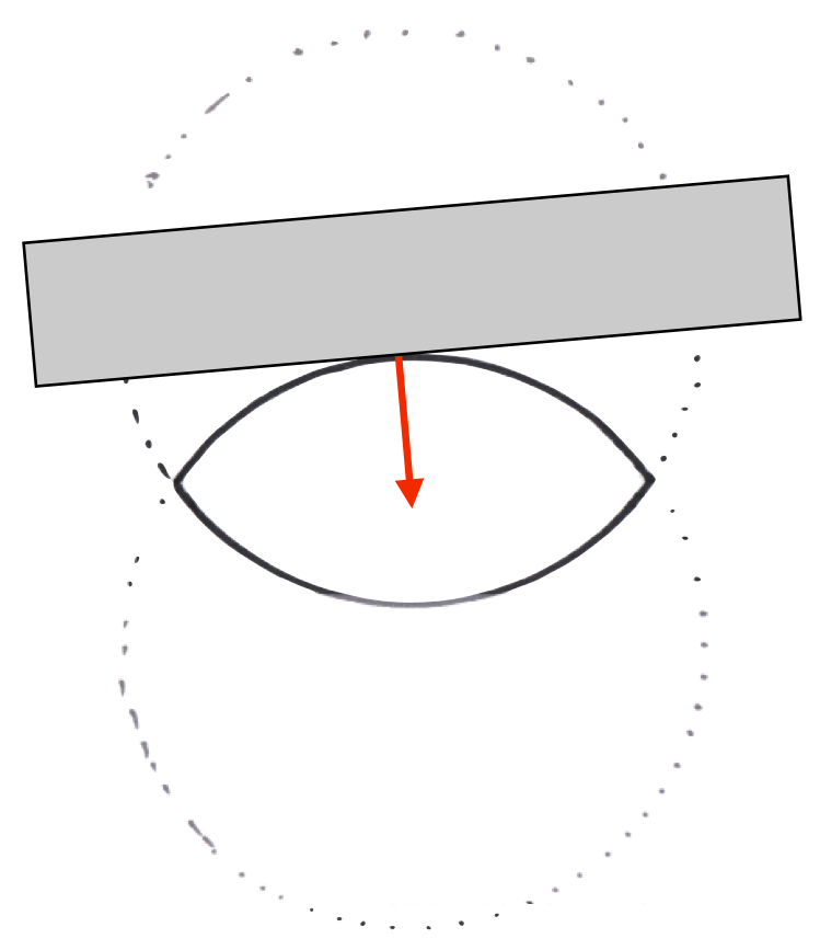 biconvex collision top